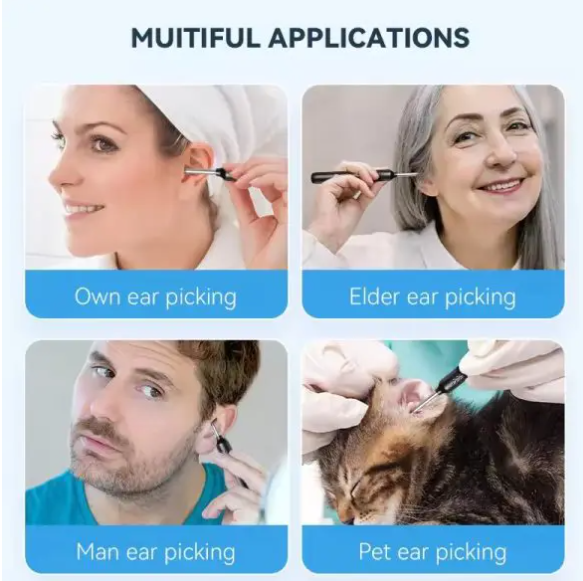 Ear Wax Removal Kit – 8-Piece Ear Cleaner with 1080P Camera, 6 Ear Spoons, iOS & Android Compatible